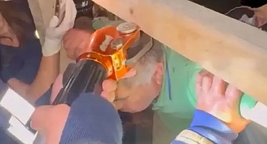 Kafasına Çivi Saplandı ...