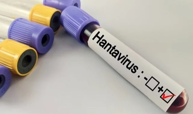 Hantavirüs salgına dönüşür mü? Kapalı alan temizliğinde büyük risk